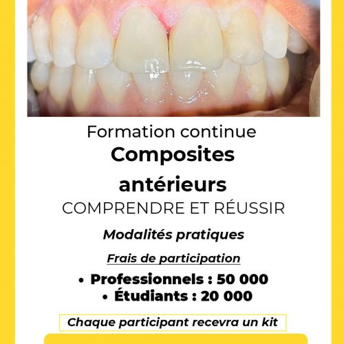 formation continue SAVI Formation continue composites antérieurs SAVI Cameroun